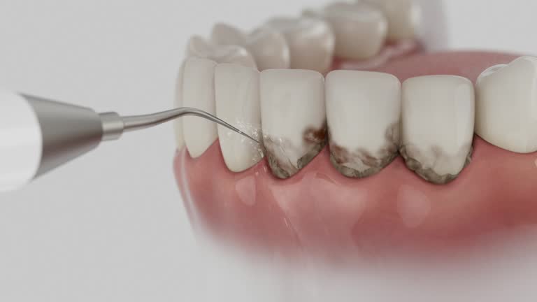 Trusted Teeth Cleaning And Checkup service in Midtown, TN - Dentist Open Now